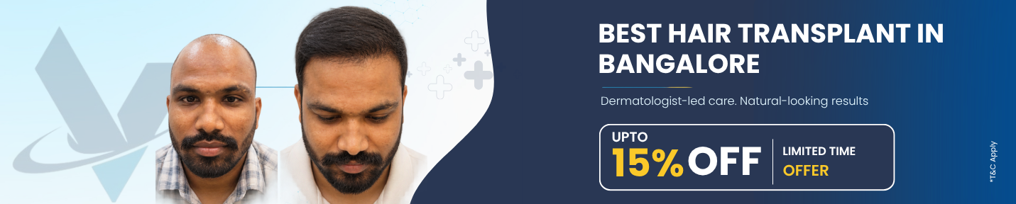 Best Hair Transplant in Bangalore – Dermatologist-led care, natural-looking results, upto 15% off limited time offer at VTIARA