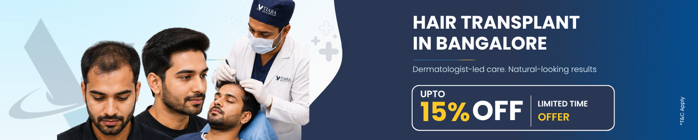 Hair Transplant in Bangalore – Upto 15% Off, Limited Time Offer at VTIARA